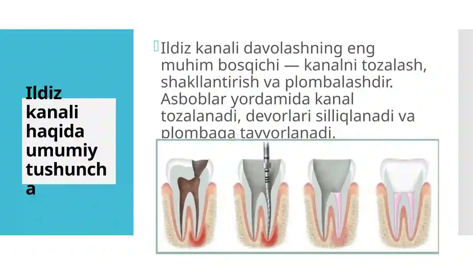 Ildizkanallarini o‘tish uchun qo‘llaniladigan asboblar 2