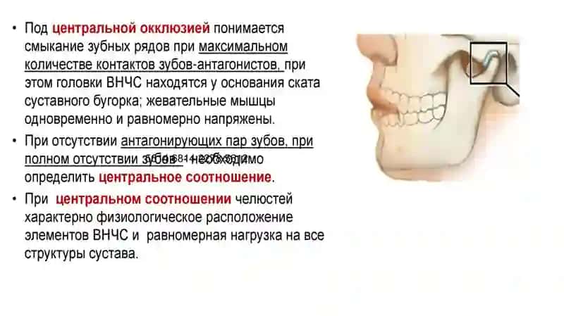 Основы определение центральной окклюзии при различных видах частичной адентии, установка искусственных зубов 2