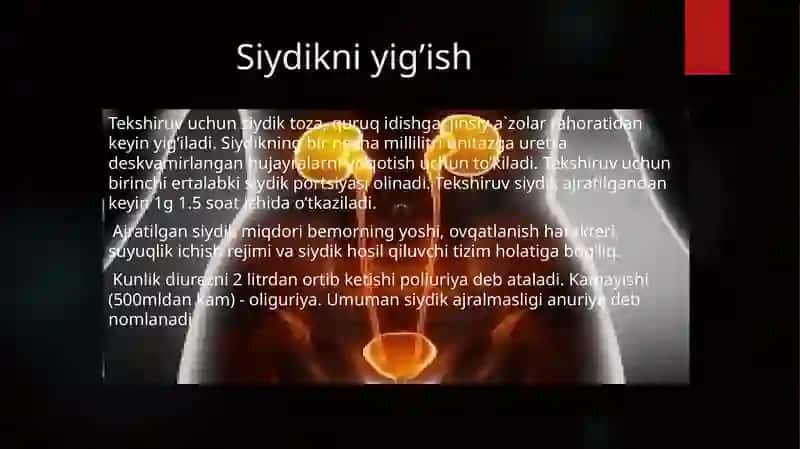 Siydikniyig’ish 2