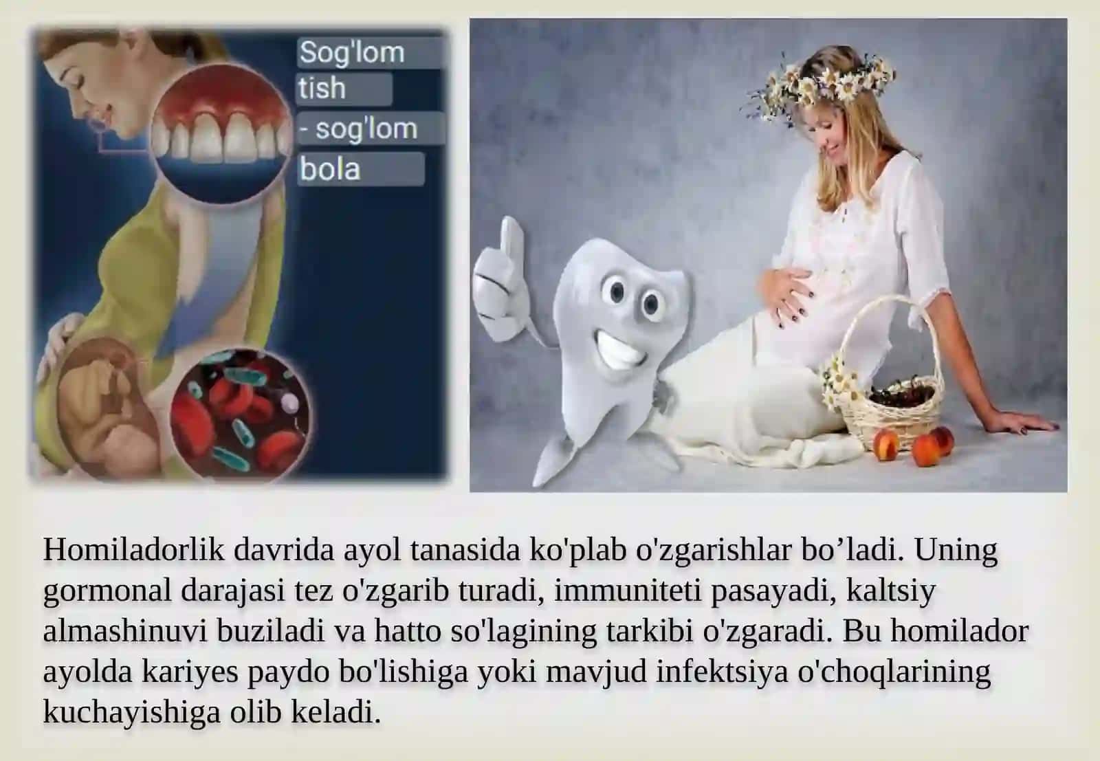 Homiladorlik davrida kariyesning individual profilaktikasi. 2