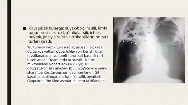 sil 2
