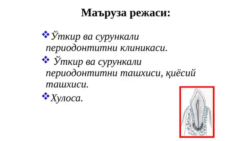 Ўткирва сурункали периодонтитларниклиникаси 2