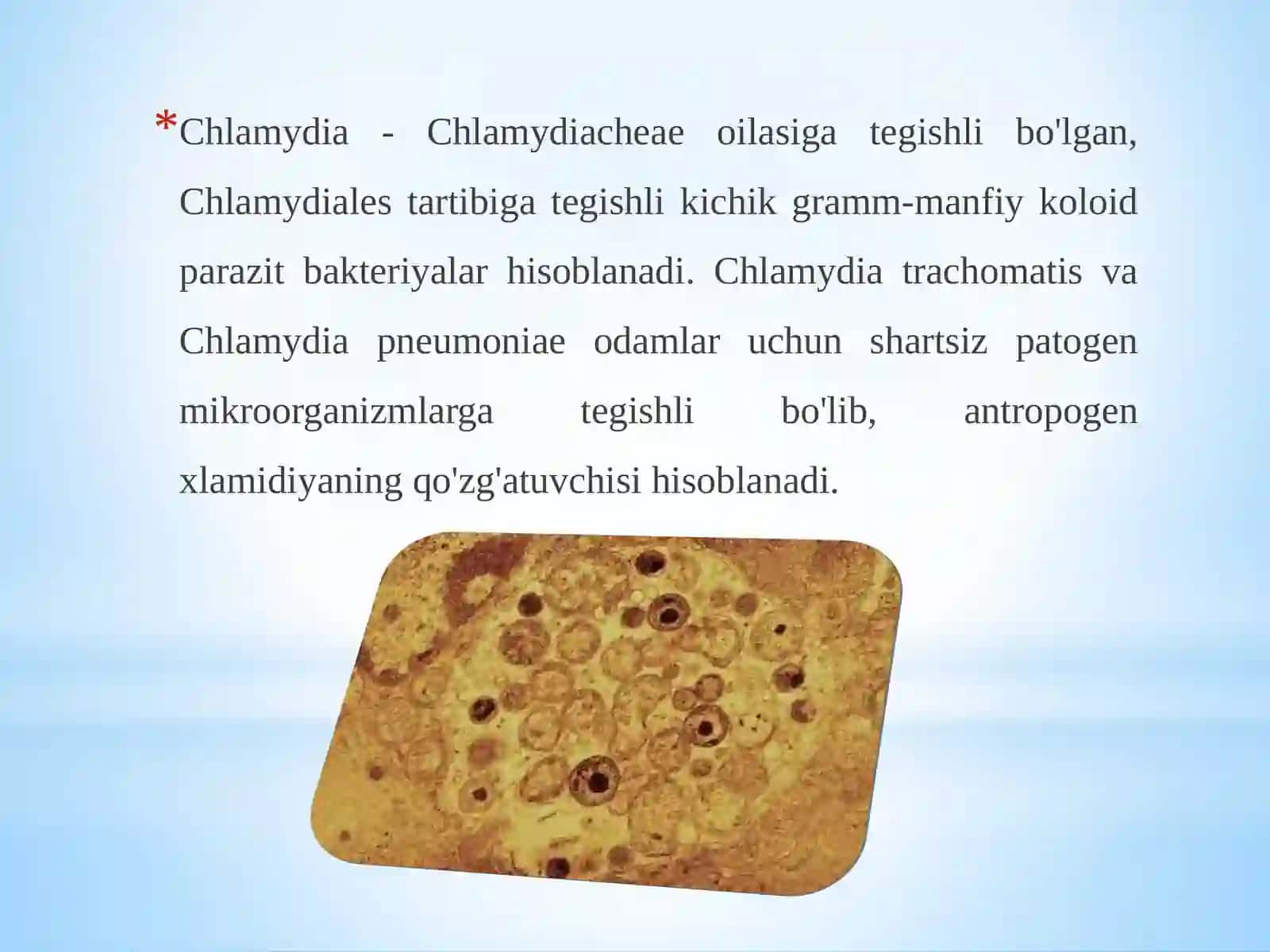 Xlamidiyalar 2