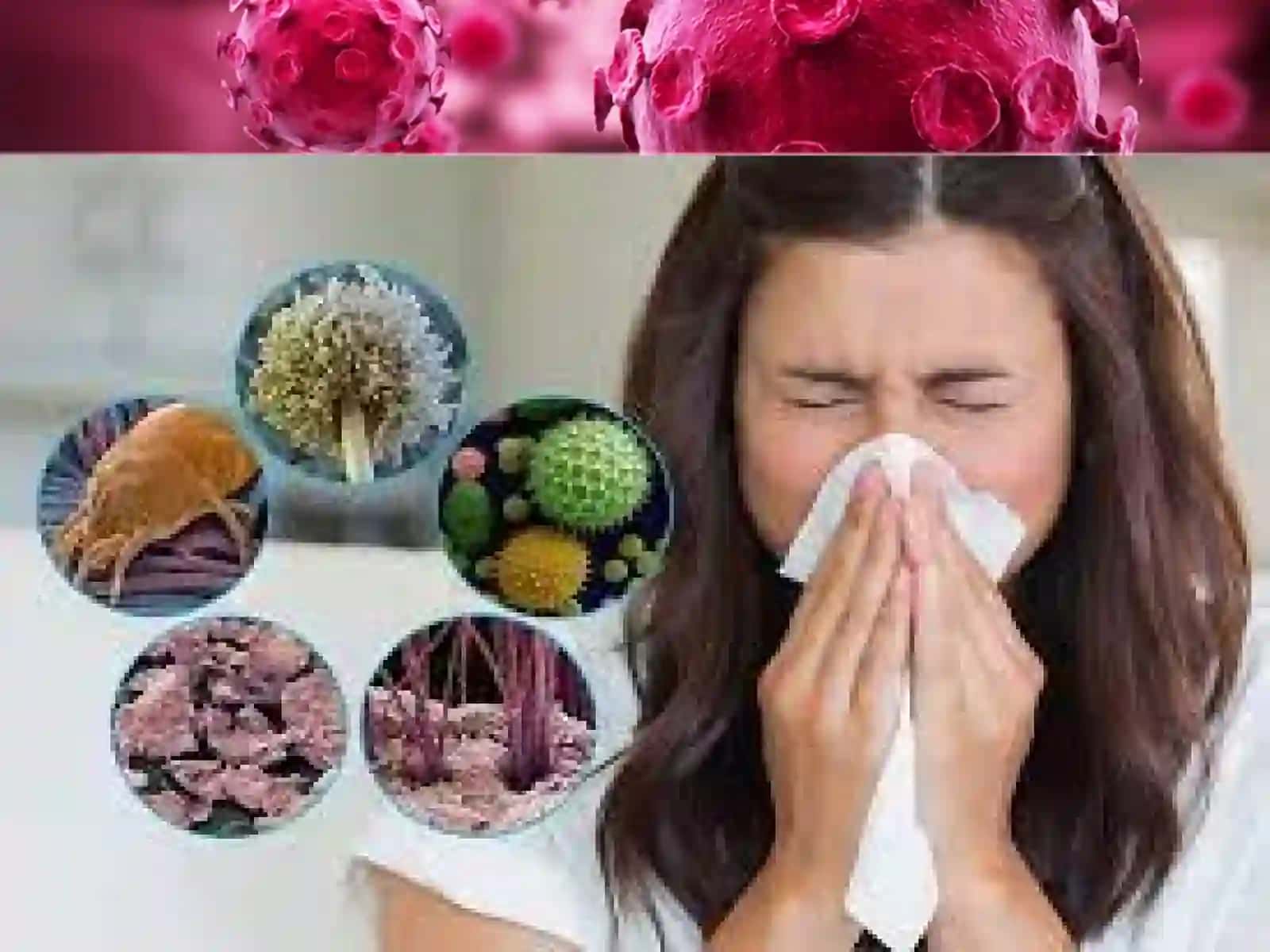 Allergiya sabablari, alomatlari tashxisi, davolash va uni qanday qilib oldini olish mumkin 2