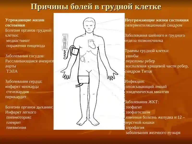 Дифференциальный диагноз некоронарогенных болей в области грудной клетки 2