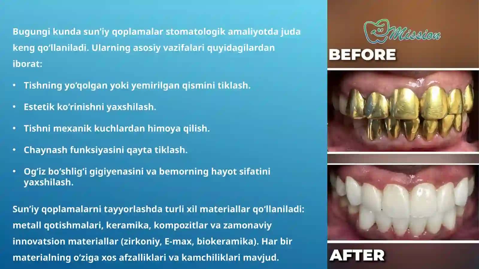 Sunʼiyqoplamalar turlari va ularni tayyorlash uchun homashyolarning qiyosiy xususiyatları 2