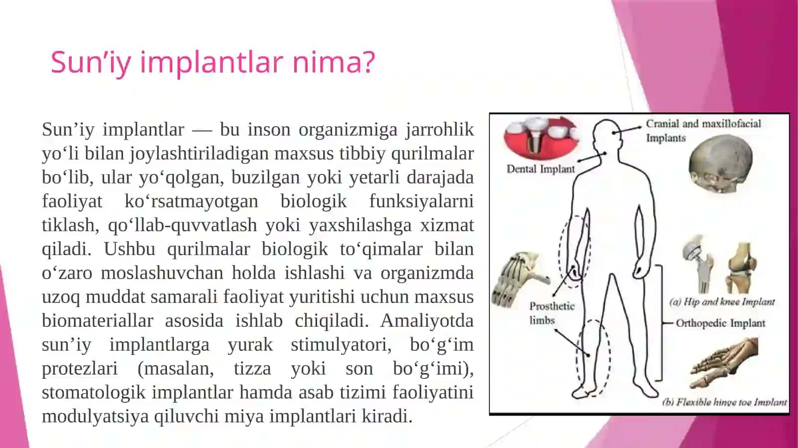 Sun’iy implantlar dizayni va AKT orqali ularni monitoring qilish 2