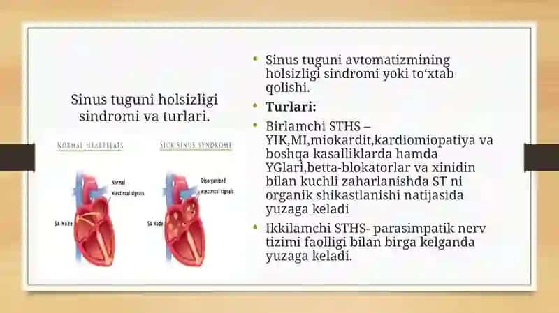 Sinustugun holsizligi sindromi 2