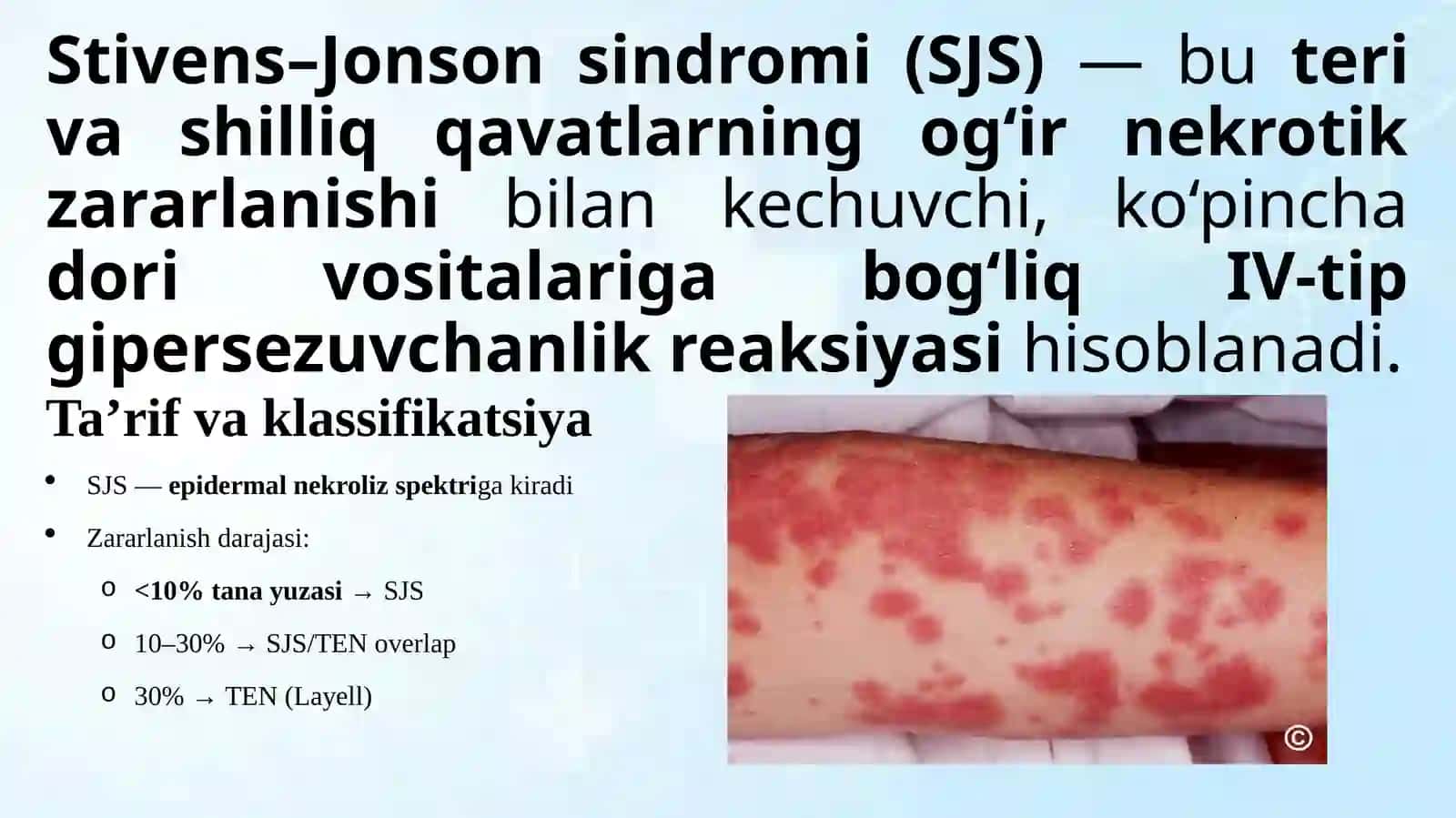 Layell va Stivens–Jonson sindromi.pptx 2
