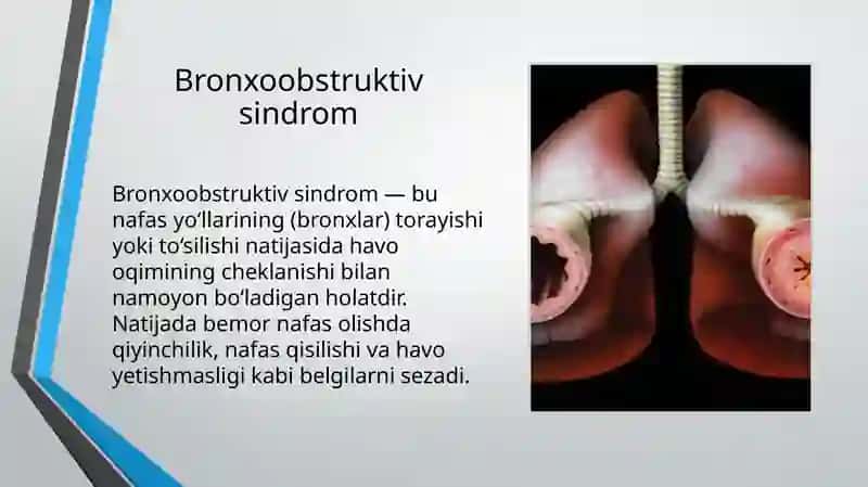 Bronxoobstruktiv sindrom 2