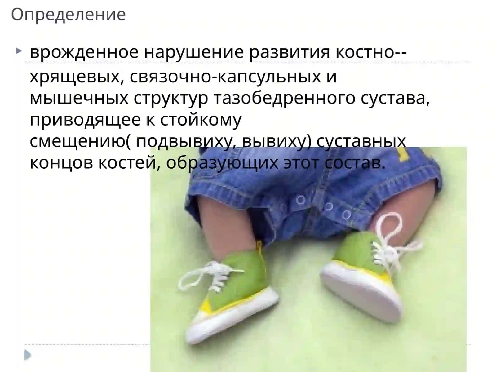врожденные вывихи бедра косолапость 2