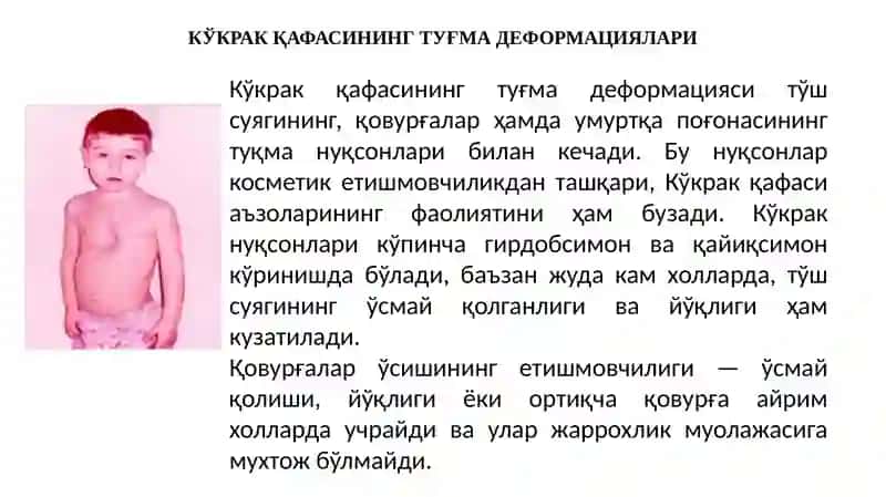 Кўкрак қафаси ва ўпканинг туғма ривожланиш нуқсонлари ва аномалиялари 2