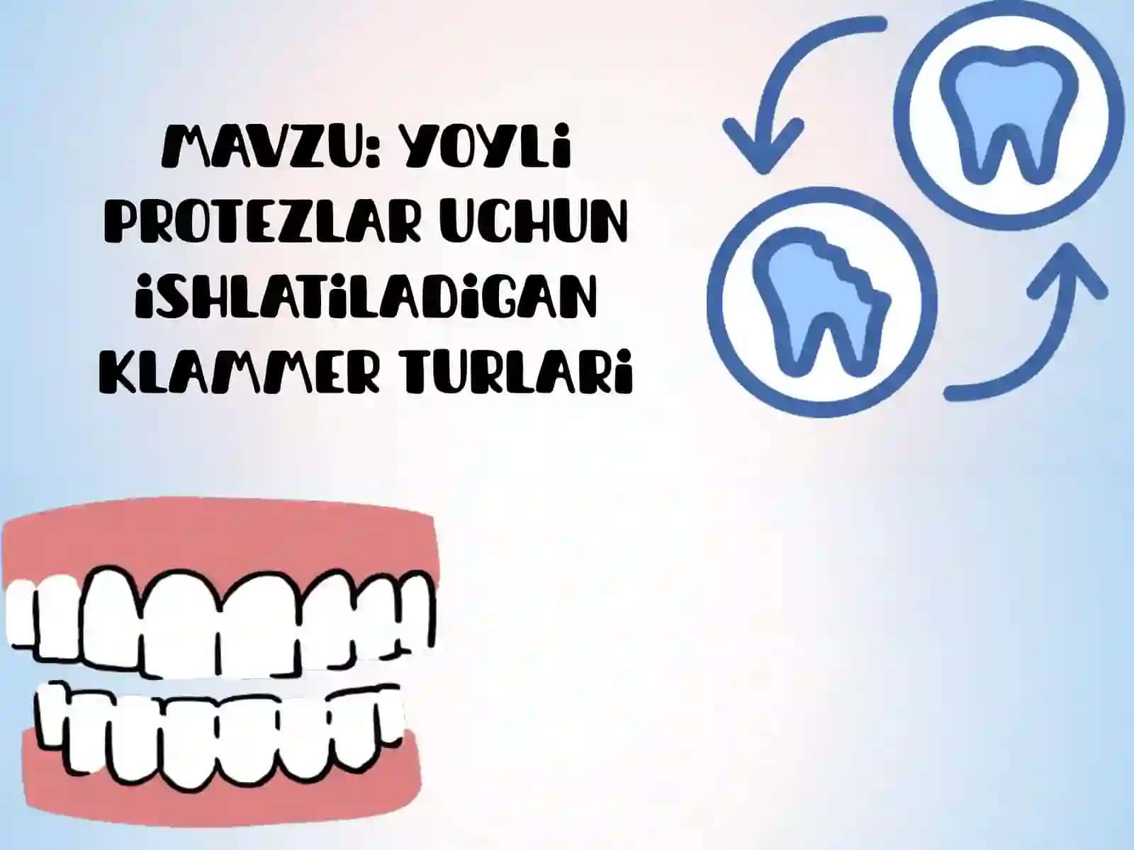 Yoyli protezlar uchun ishlatiladigan klammer turlari 2
