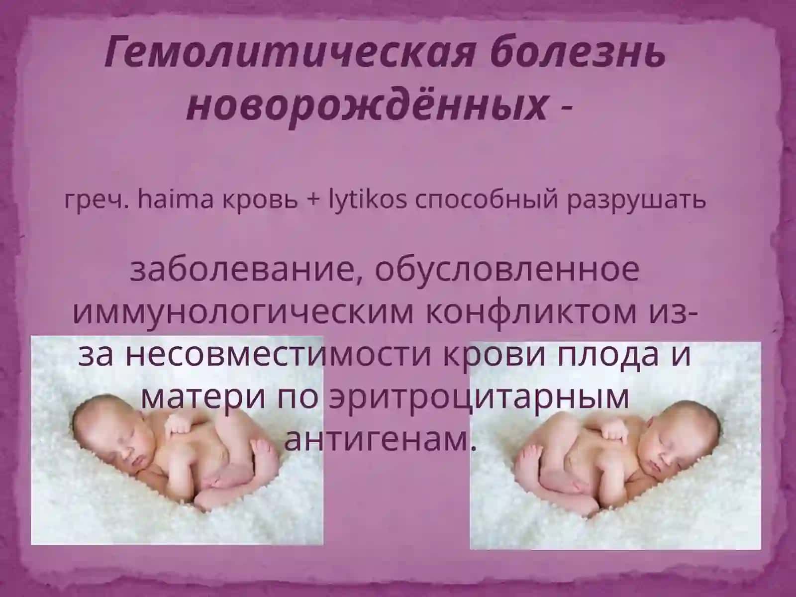 Гемолитическая болезнь новорожденных 2