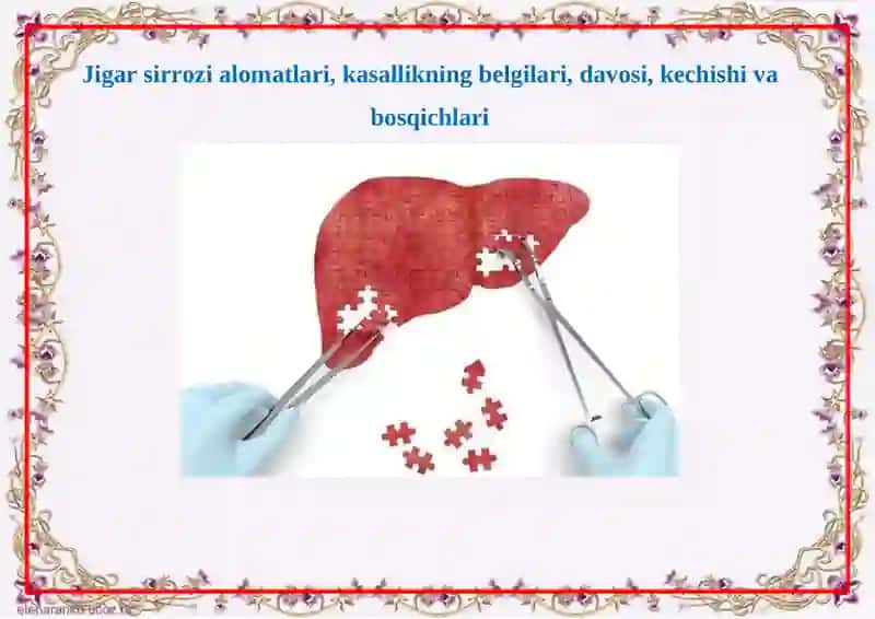 SOMATONEVROLOGIK SINDROMLAR 2