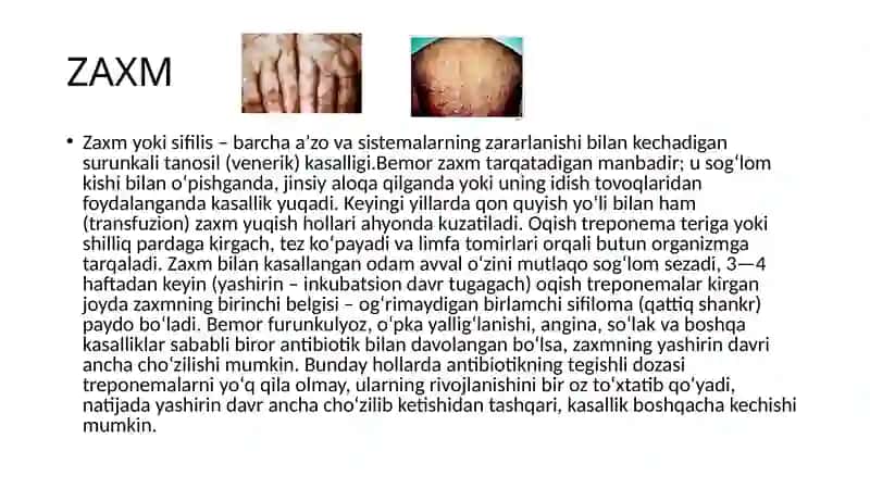 Infeksiya yuqqan homilador ayollarni olib  borish. Fetoplasentar yetishmovchilik haqida tushuncha, uning asoratlari 2