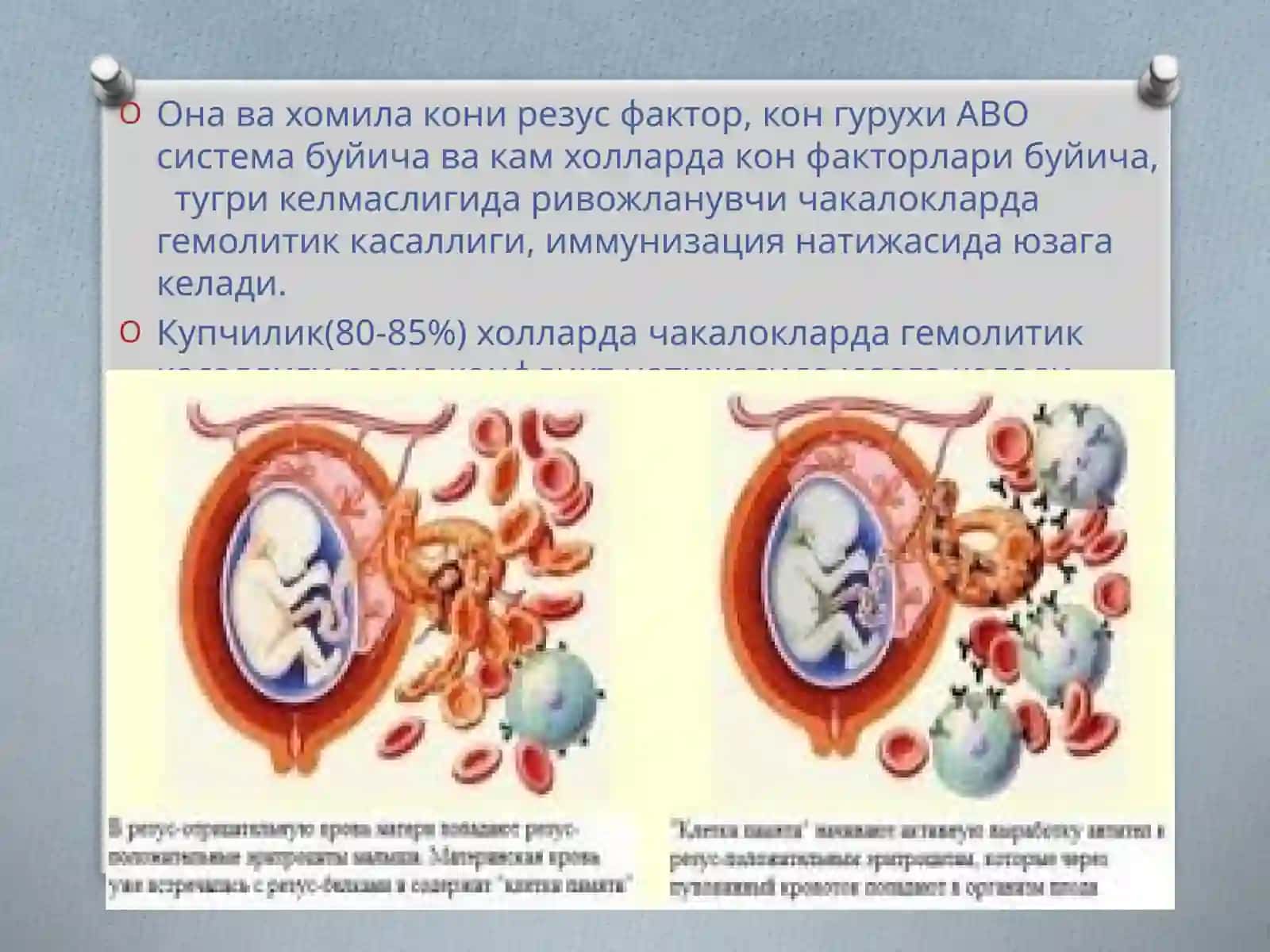 Чақалоқларда сариқлик. ЧГК 2