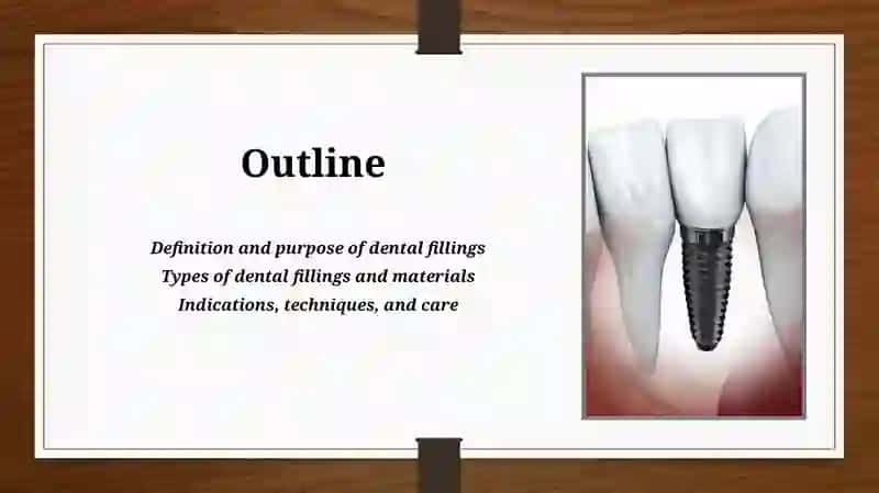 Dental Fillings 2