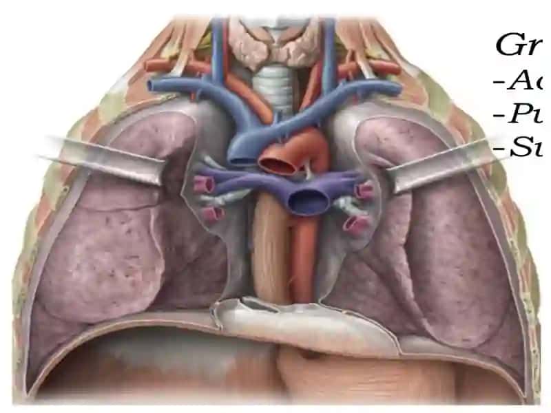 MEDIASTENIT 2
