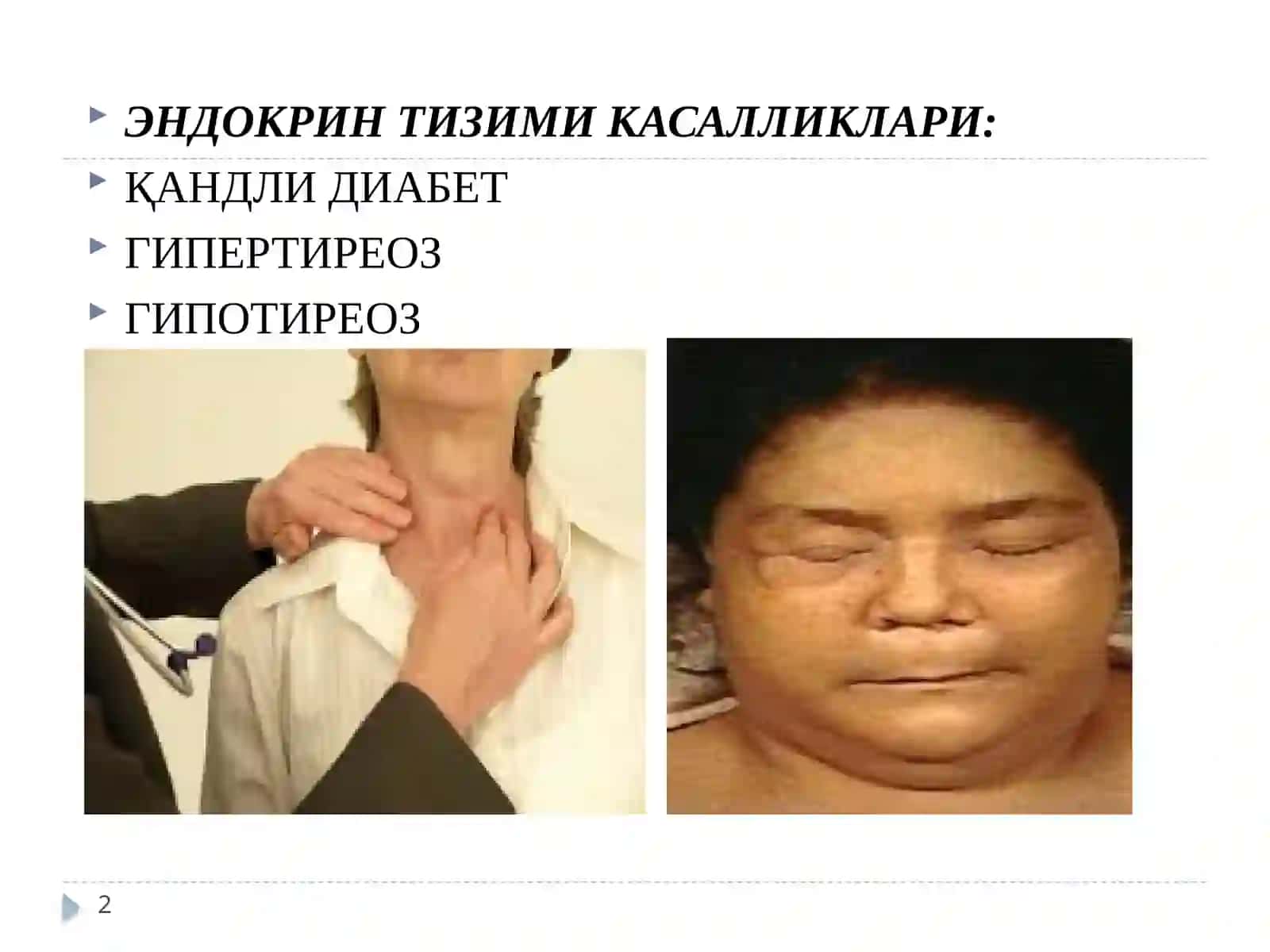 Эндокрин тизими касалликларида ҳамширалар томонидан олиб бориладиган текширувлар ва муолажалар, ҳамширалик парвариши 2