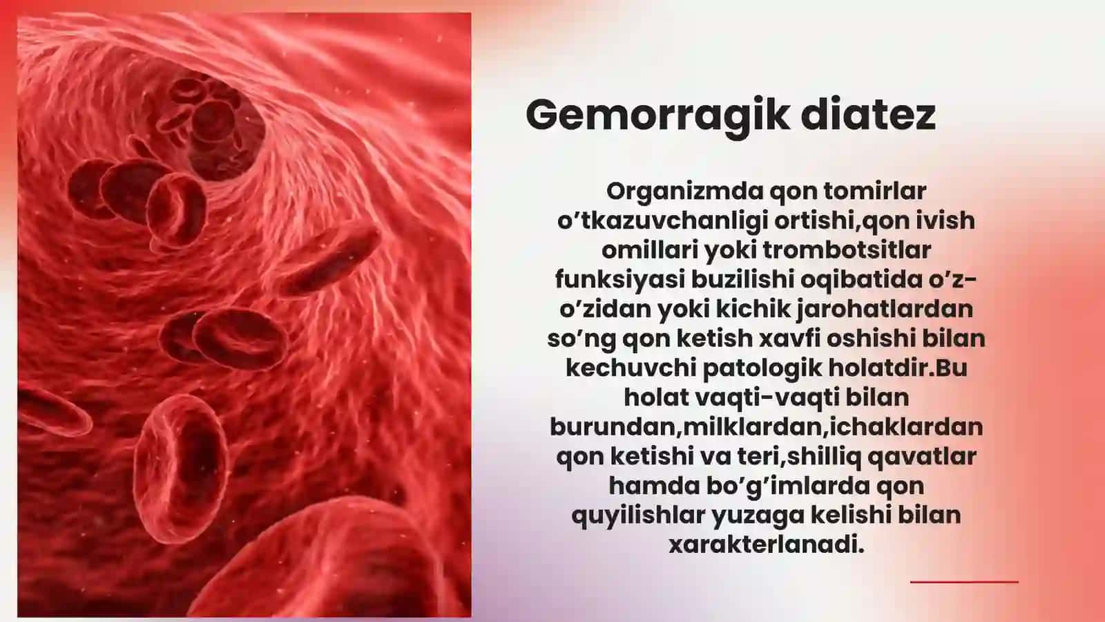 Gemorragil diatez 2