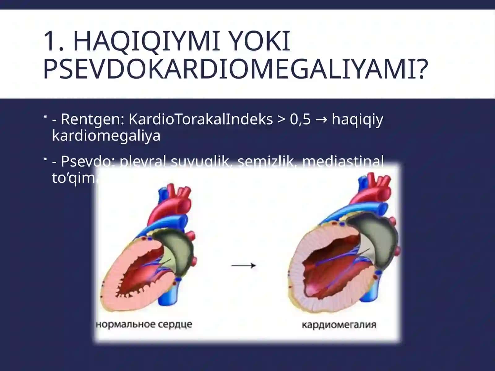 Kardiomegaliya 2