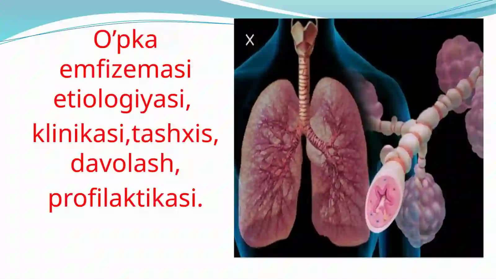 O’PKA EMFIZEMASI 2