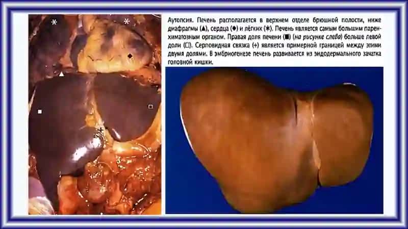 ПАТОЛОГИЯ ПЕЧЕНИ И ЖЕЛЧЕВЫВОДЯЩИХ ПУТЕЙ 2