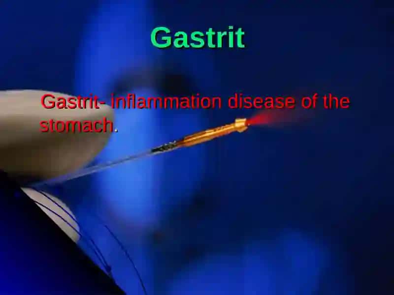 Gastrit 2