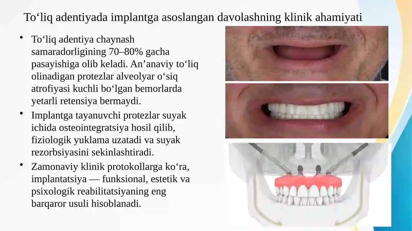 Umumiy amaliyot shifokori stomatologining zamonaviy klinik  protokollar asosida tish implantlaridan 2