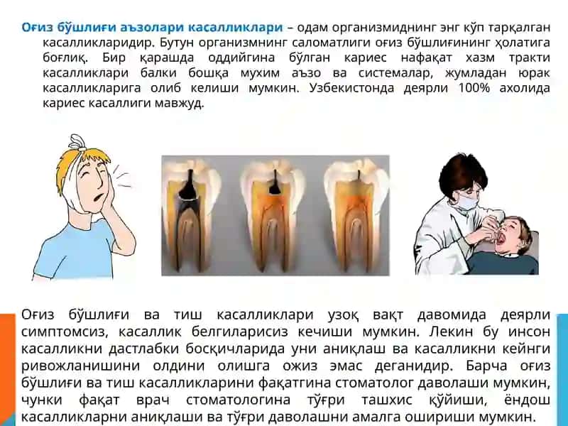 Оғизбўшлиғининг Профессионал гигиенаси. Кариес профилактикаси 2
