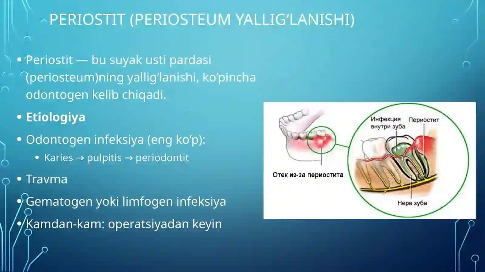 Yuz jagʻa kasalliklari: Periastit abses flegmona 2