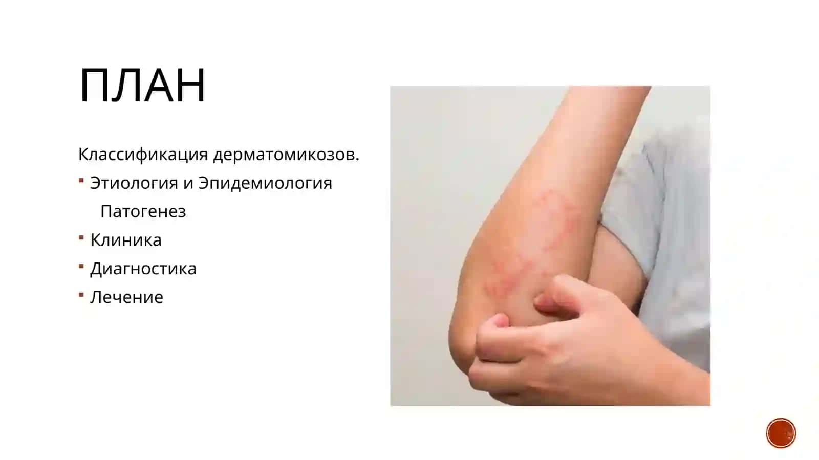микозы 2
