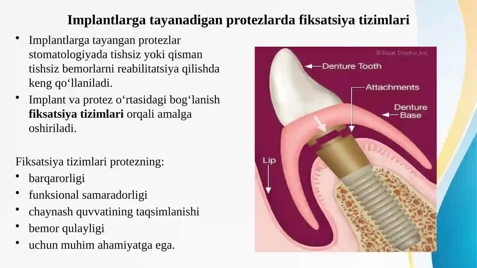 Tish shifokori umumiy amaliyot shifokorining olinmaydigan tish implantlariga tayanadigan tish protez 2