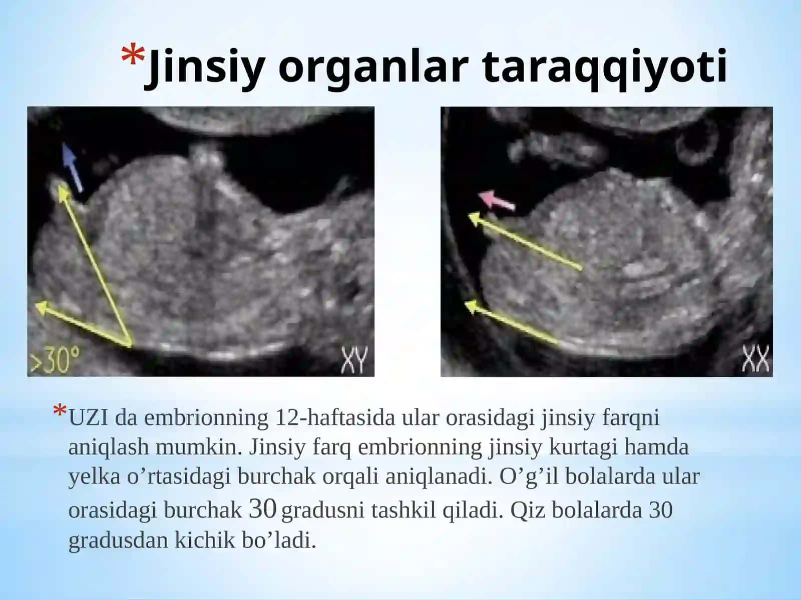 Jinsiy organlarning taraqqiyoti 2
