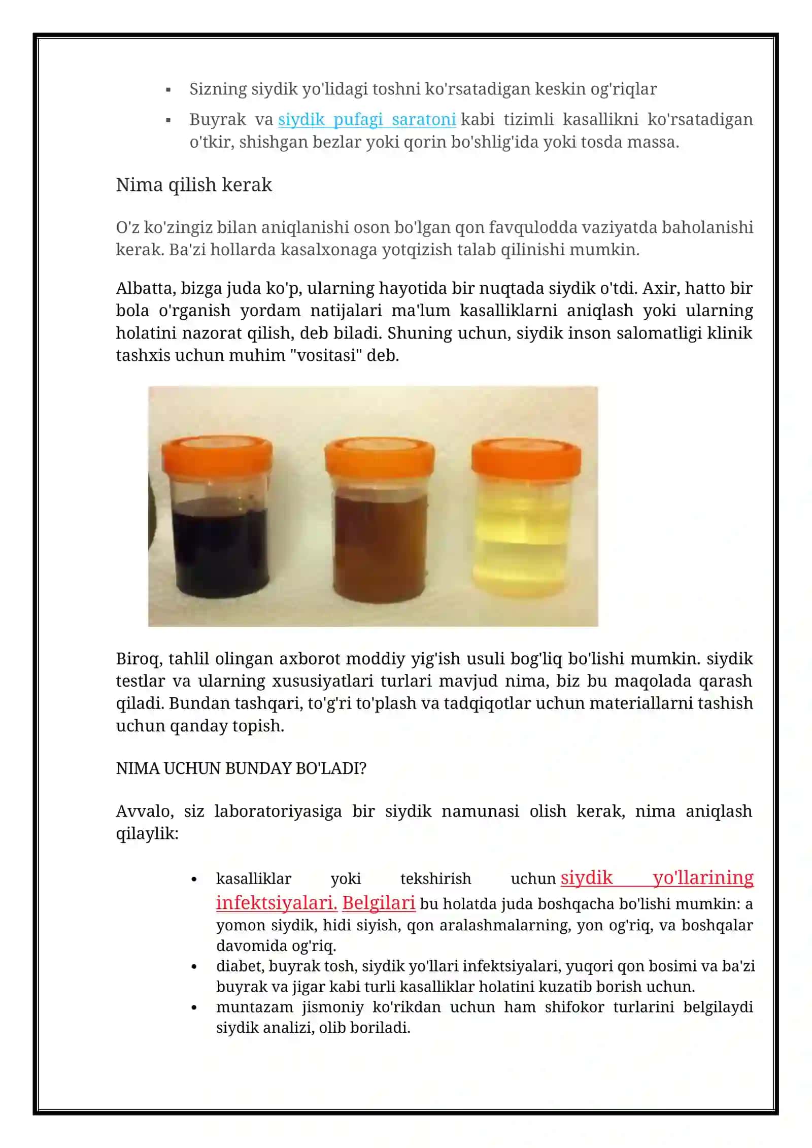 Siydikdagi qon sabablari 2