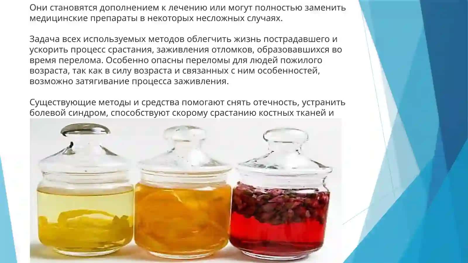 Лечение переломов костей народными средствами 2