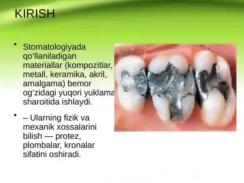Stomatologik materiallarning fizik-mexanik xossalari. Tish zichligini aniqlash. Sun’iy tish materiallarining mexanik xossalari 2