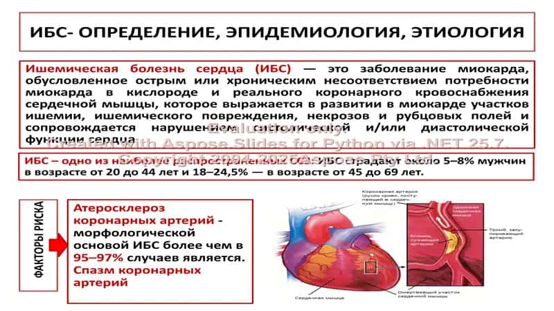 Ишемическая болезнь сердца. Классификация и симптомы 2