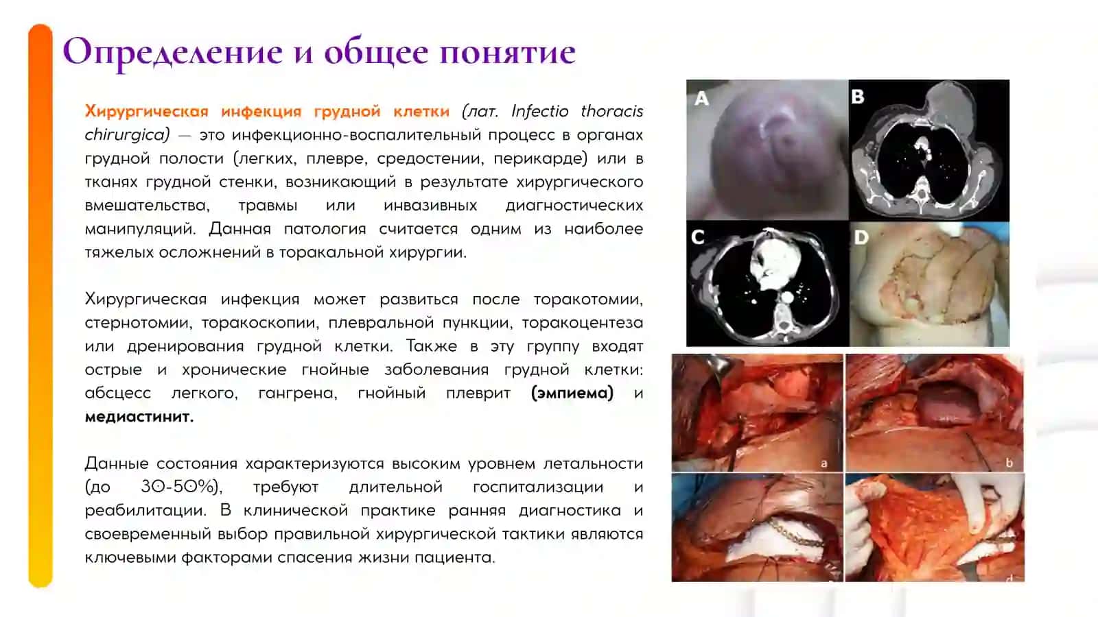 Хирургическая инфекция груднойклетки 2