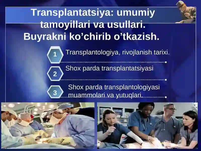 Transplantologiya 2