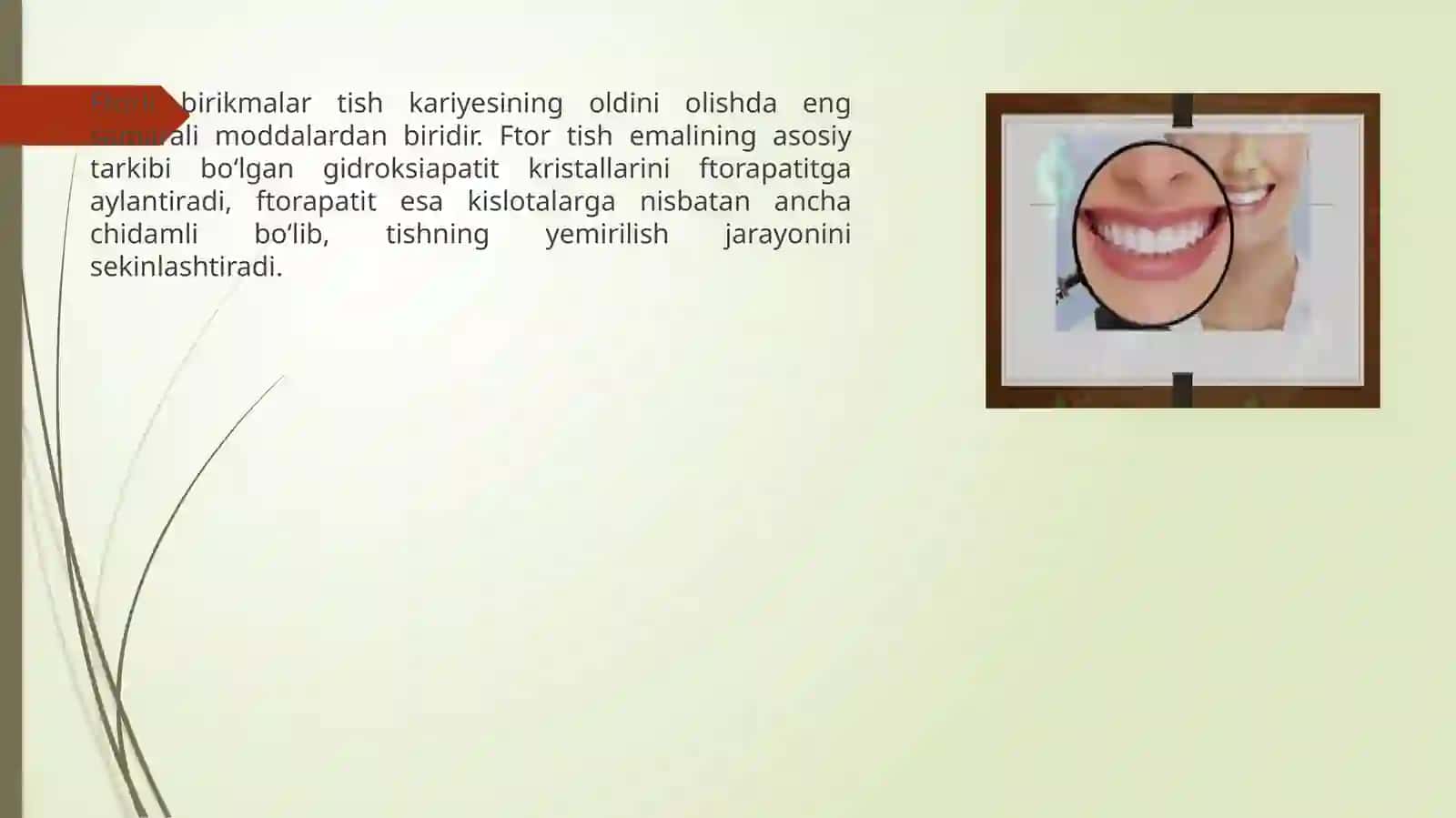 Flor ftorli birikmalarni tish kariesi profilaktikasidagi o'rni 2