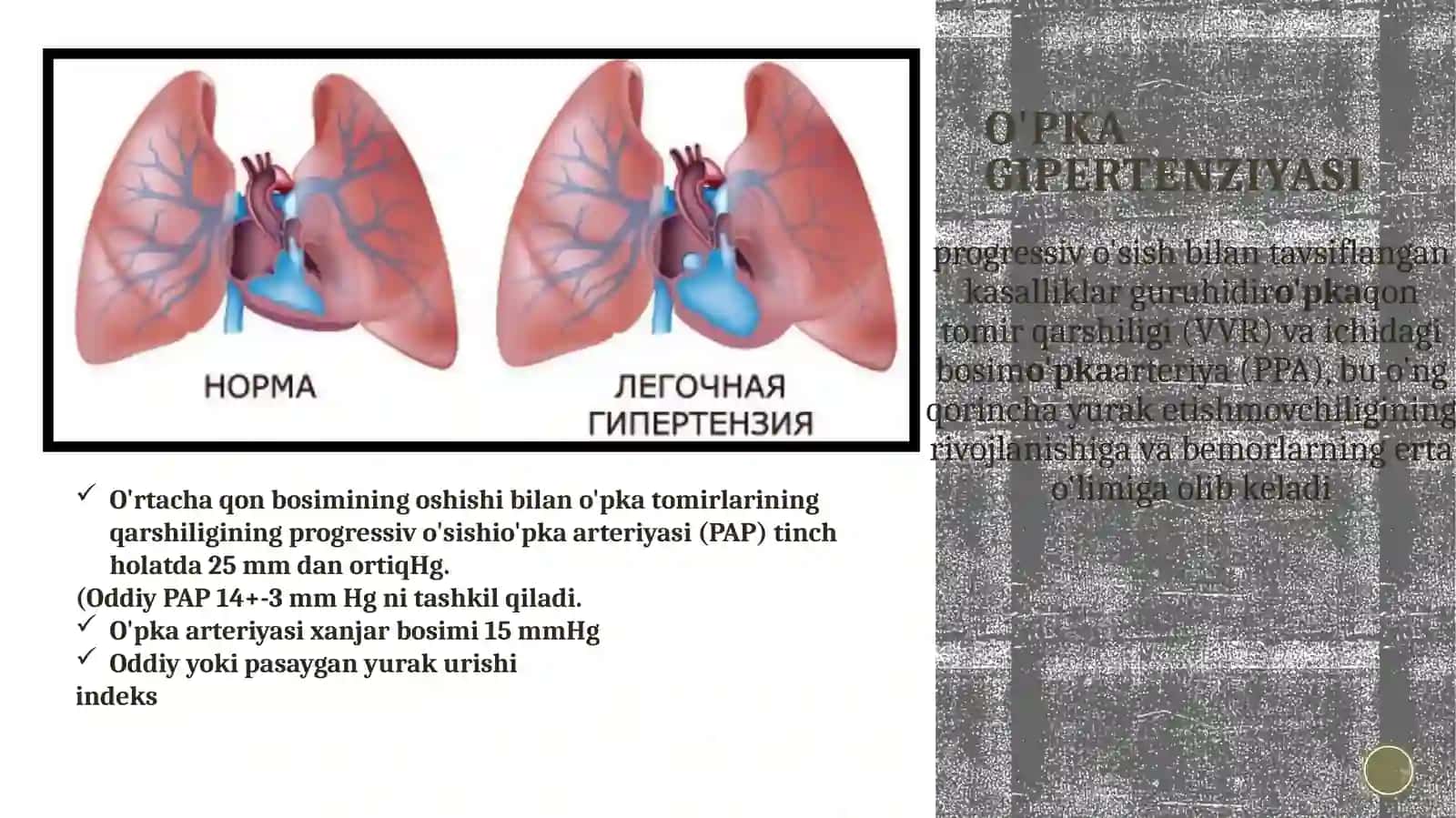 O’pka gipertenziya 2