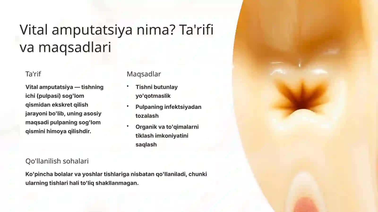 Stomatologiyada vital amputatsiya: Asosiy tushunchalar va usullar 2