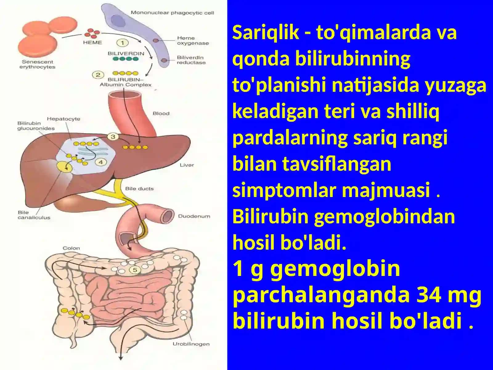 YANGI TUG'ILGAN CHAQALOQLARDA SARIQLIK 2