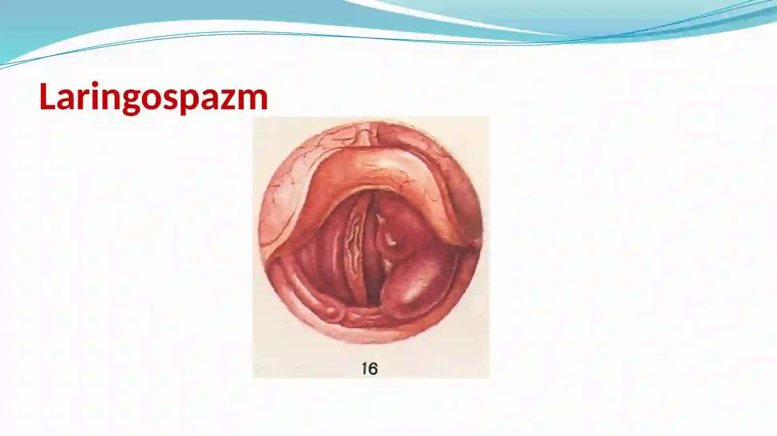 Laringospazm.Tez yordam algoritmi 2