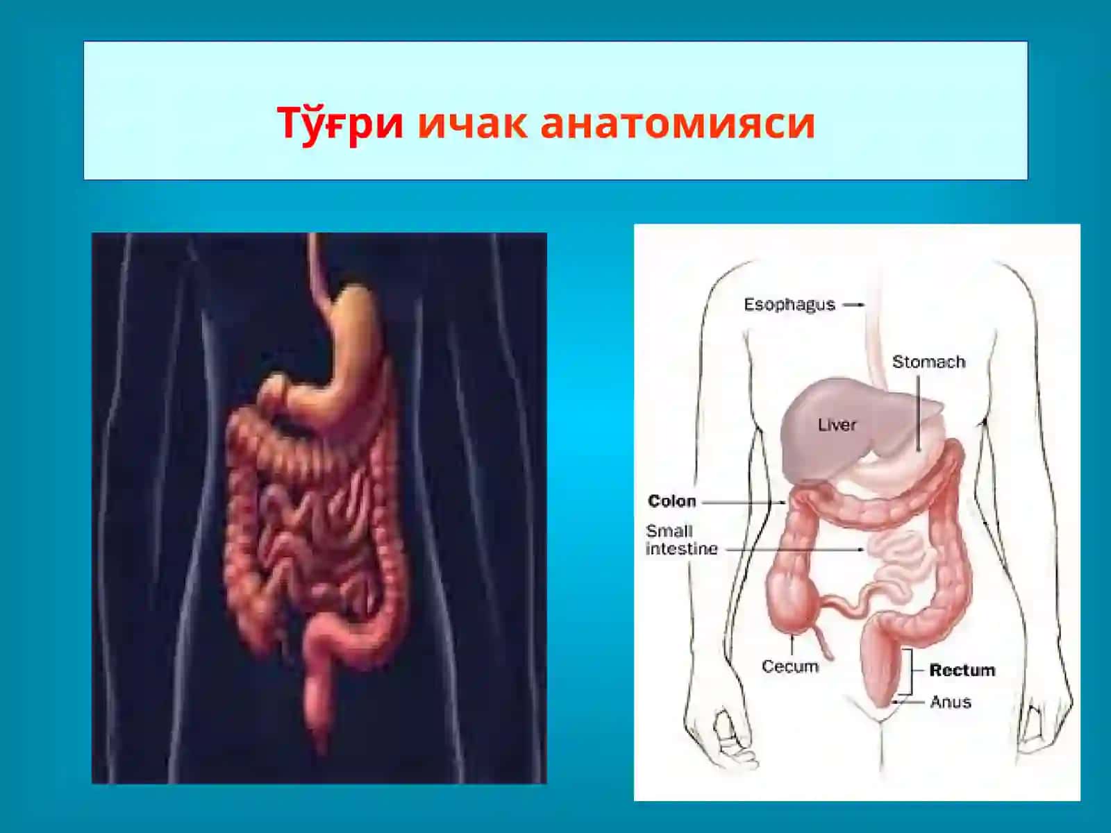 Тўғри ичак касалликлари 2