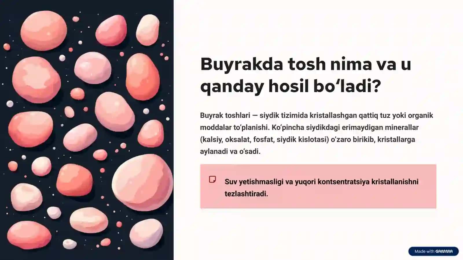 Buyrakda tosh hosil bo'lishi sabablari va mexanizmlari 2