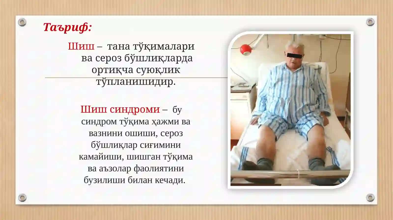 Шиш-Асцит Синдроми | Tibbiy Prezentatsiya | PowerPoint | Yurak, Buyrak, Jigar Kasalliklarida shish 2