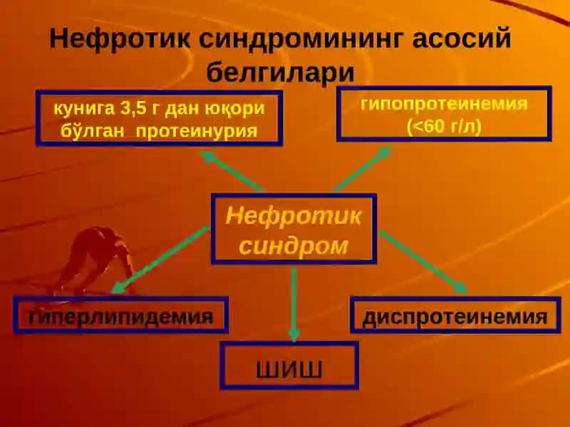 Нефротик синдром киёсий ташхиси ва умумий амалиёт врачи тактикаси 2
